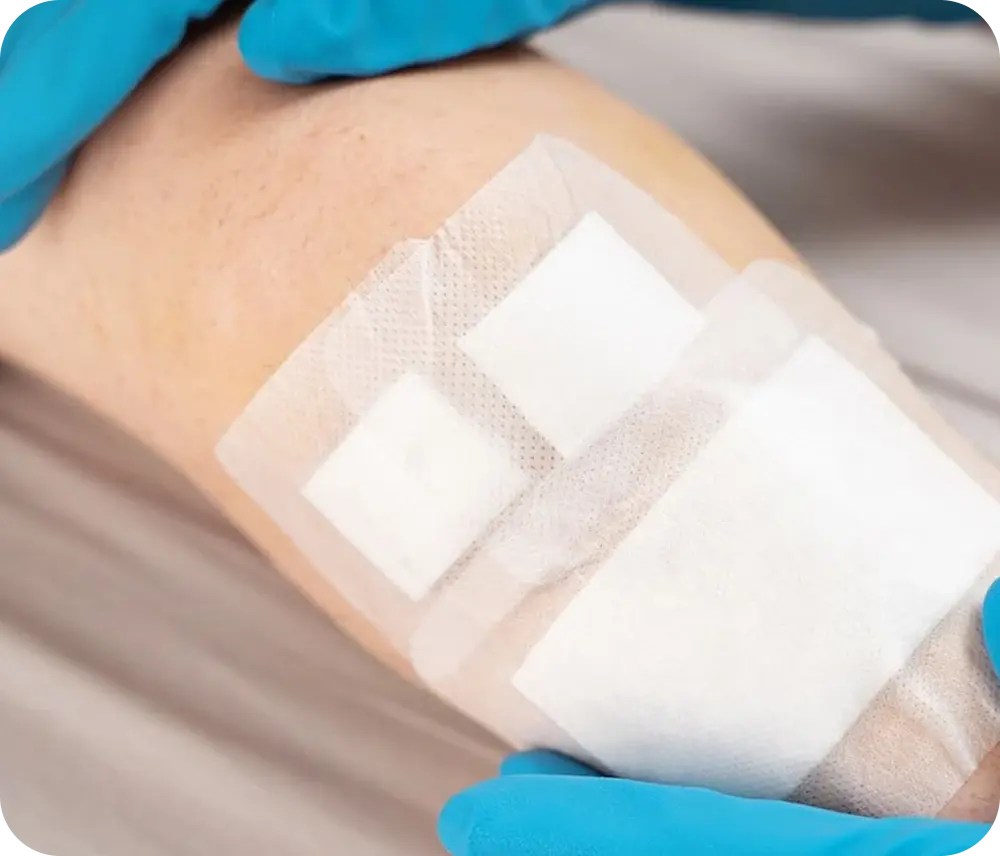 Bandaged arm resting on a table