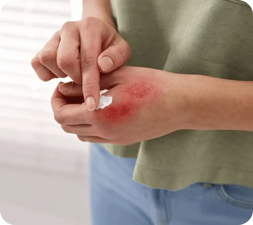 Nurse dressing a patient’s wound